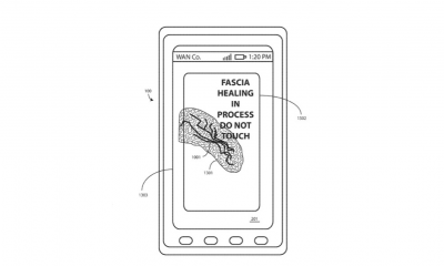 zelfherstellend beeldscherm